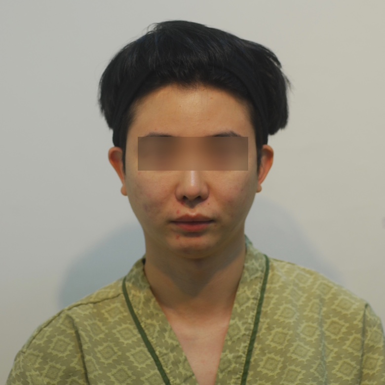 치료 전 이미지
