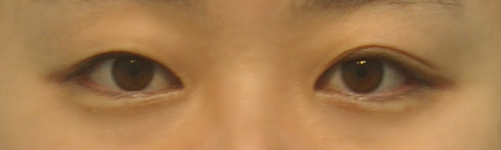 치료 전 이미지