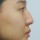 치료 전 이미지