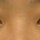치료 전 이미지