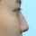 치료 전 이미지