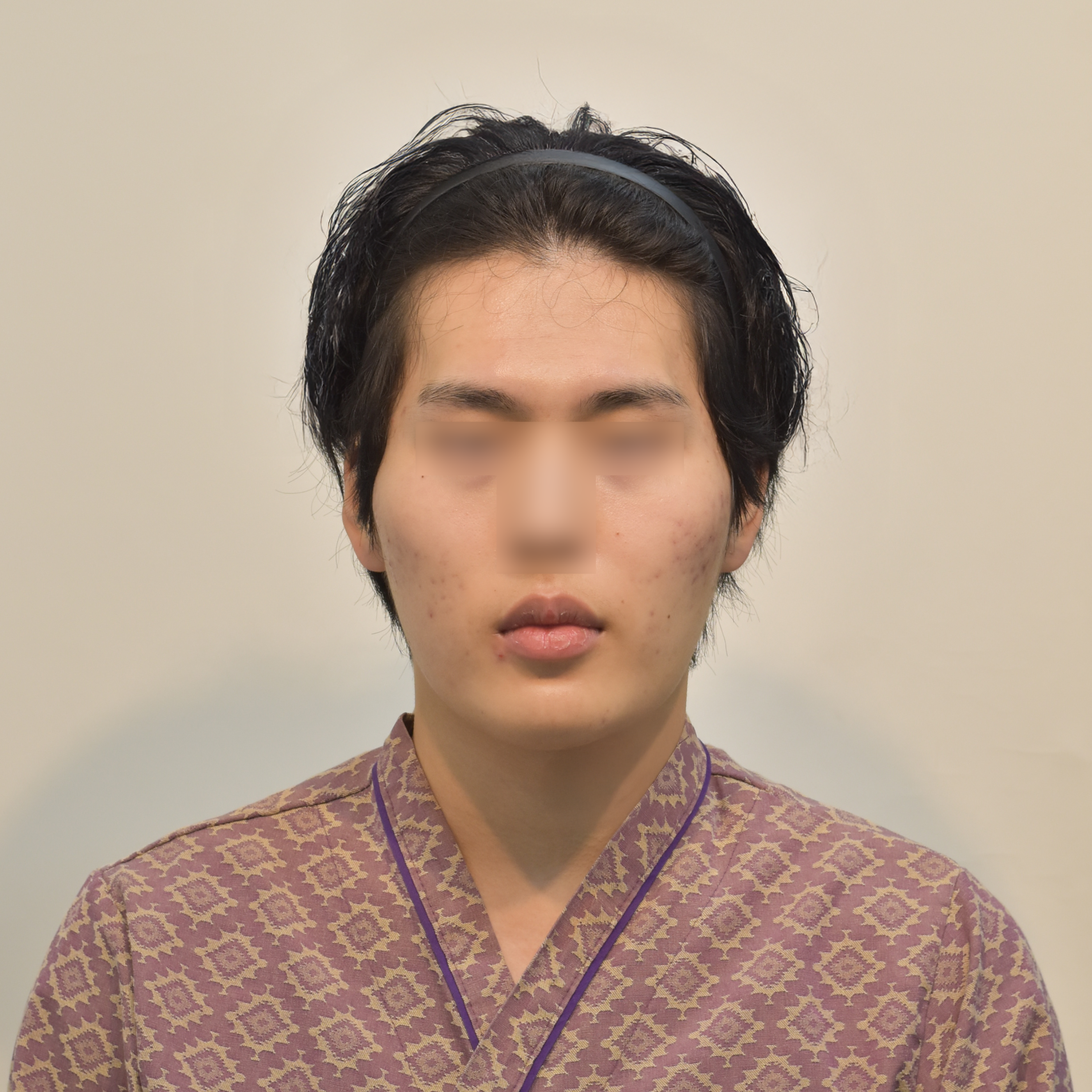치료 전 이미지